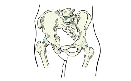 Pubic Rami Fractures