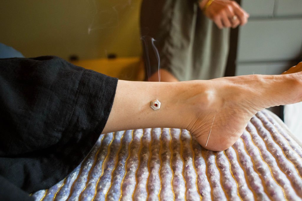 Work With Kristin Misik — KM Acupuncture