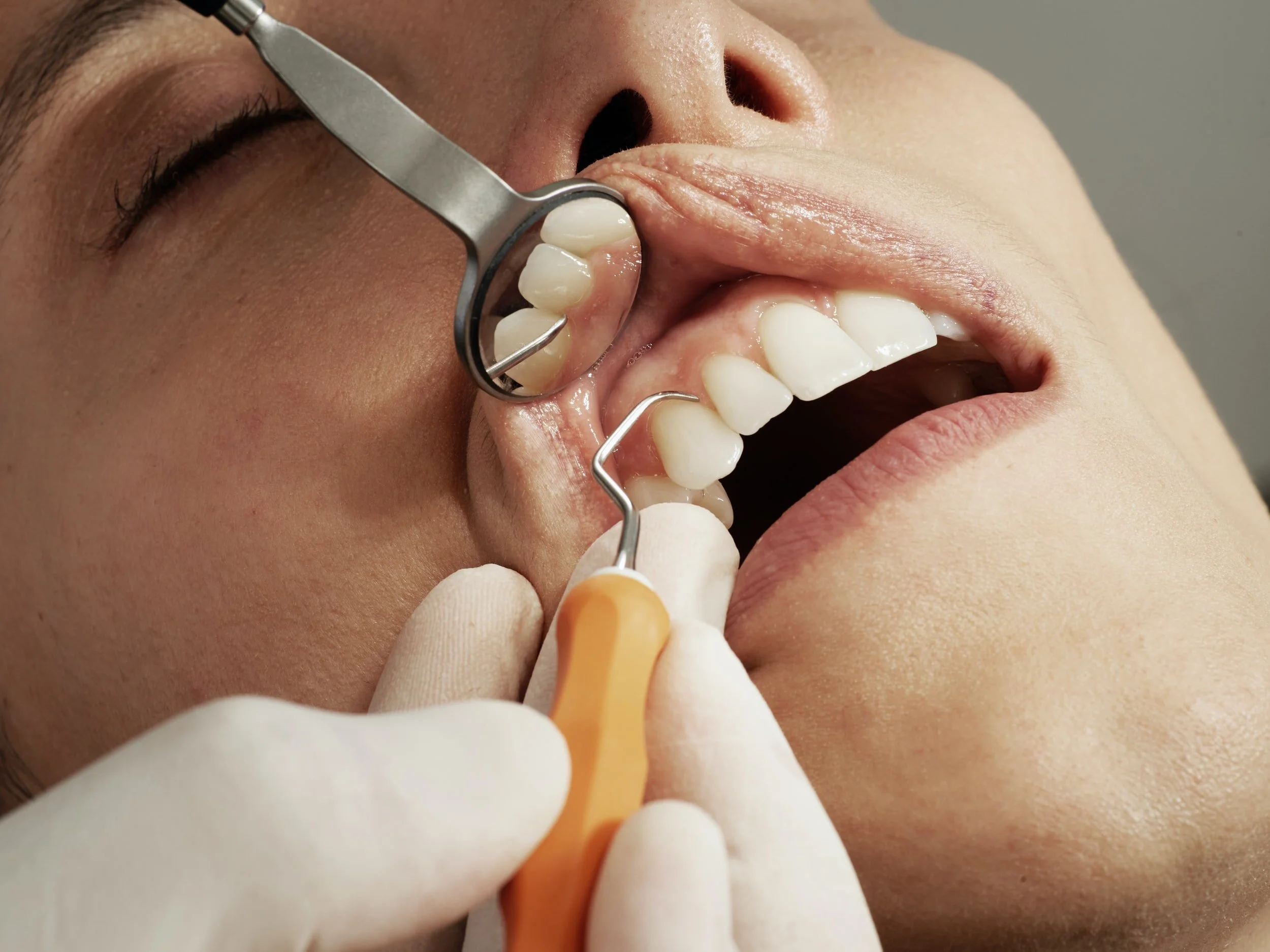 Close-up of a patient with their mouth open during a dental exam, with a dental mirror and scaler being used by a gloved dental professional.