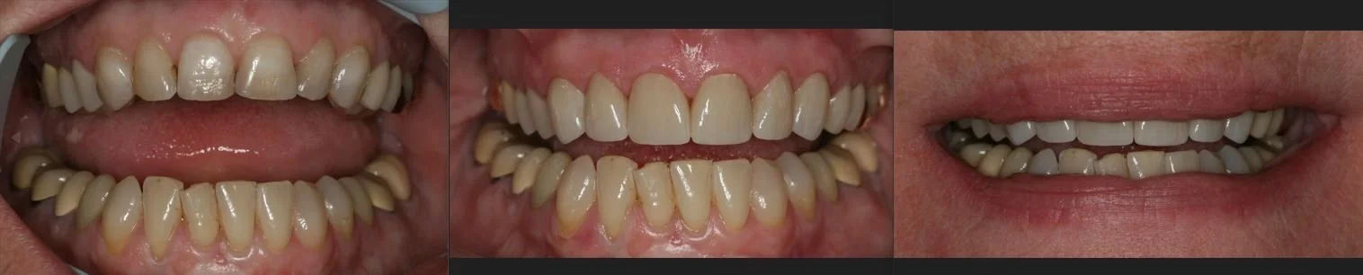 Close-up images of people's teeth and mouths showing dental conditions and smiles.