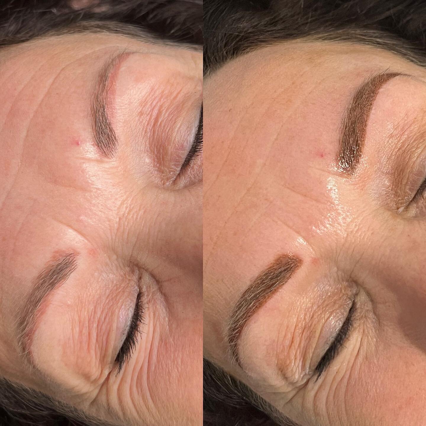 Powder Brow Colour Correction over some old microblading/ feathering

&mdash;&mdash;&mdash;&mdash;&mdash;&mdash;&mdash;&mdash;&mdash;&mdash;&mdash;&mdash;&mdash;&mdash;&mdash;&mdash;&mdash;&mdash;&mdash;&mdash;&mdash;&mdash;
🖊Technique: Powder Brows