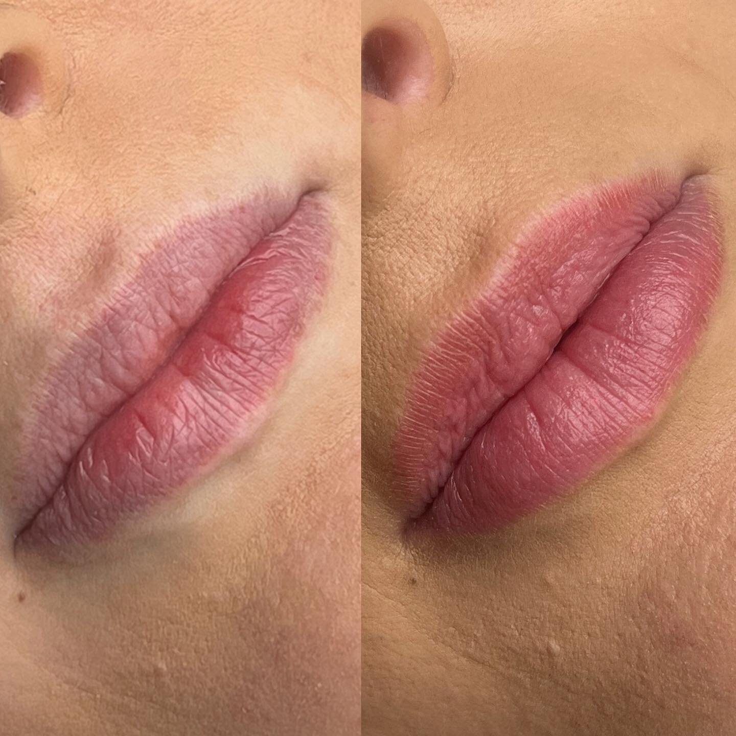 HEALED Lip Blush 🥰 👄 

Benefits of Lip Blush-
- Adds colour
- Creates definition
- Can create the illusion of bigger lips
- No need for makeup in the day
- Will get rid of any blue undertones from filler or age