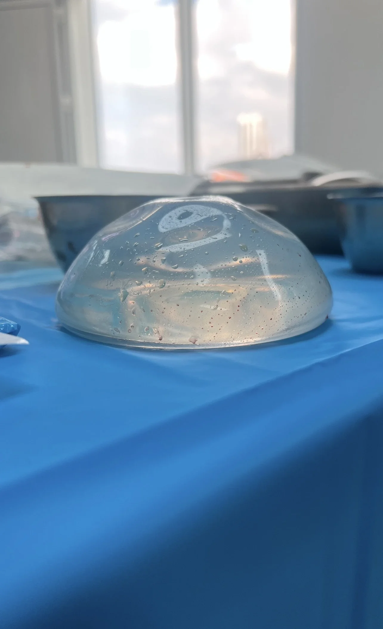 Breast Augmentation: Everything You Need to Know Before Your Surgery
