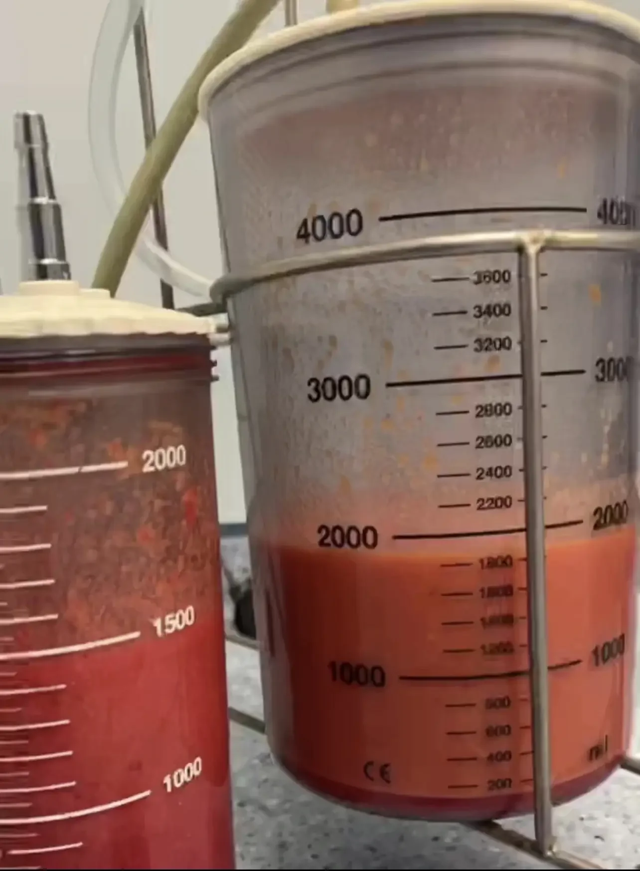 Fat Transfer Surgery: Natural Body &amp; Facial Enhancement Using Your Own Fat