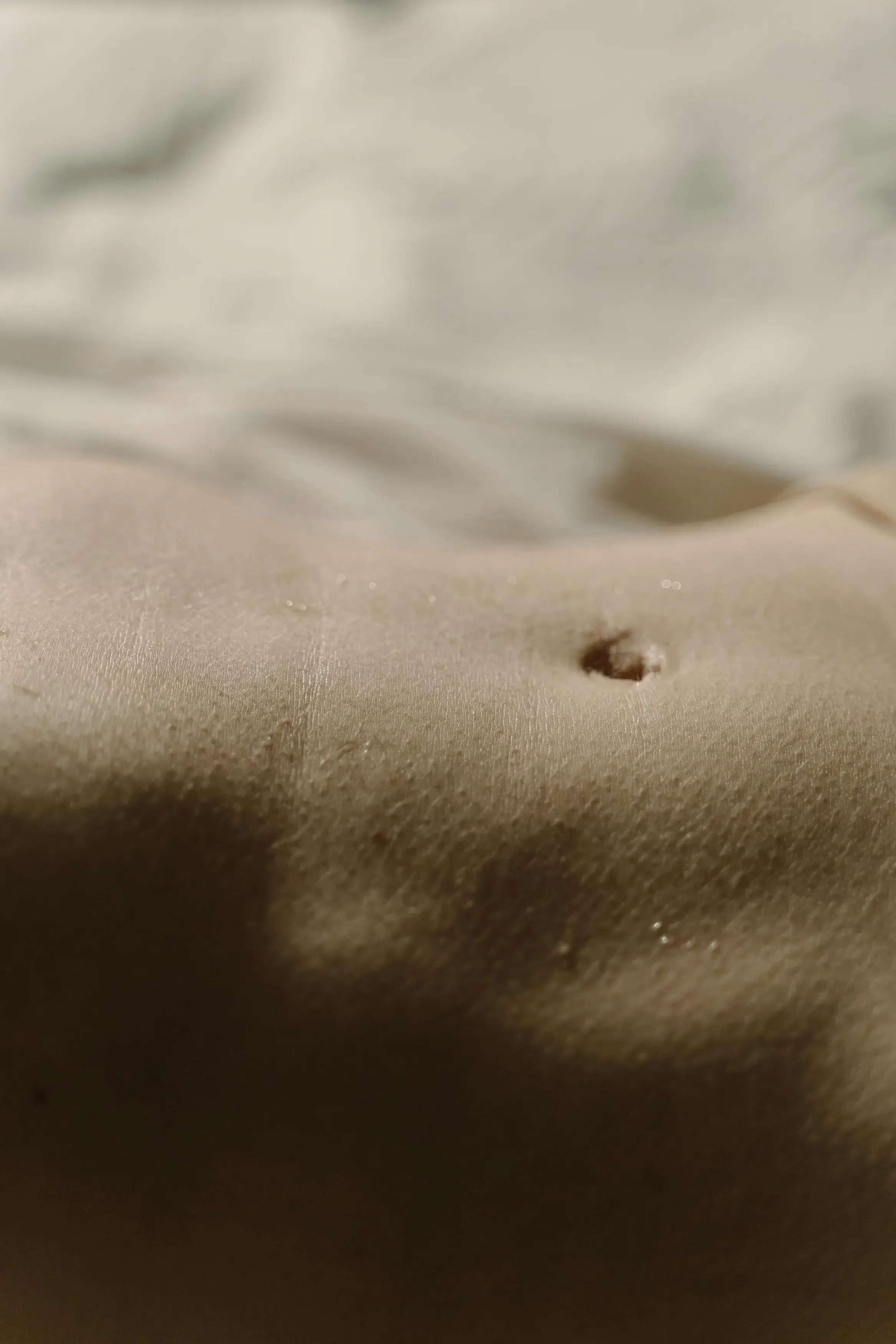 Liposuction Surgery: Everything You Need to Know About Fat Removal, Results, Recovery &amp; Safety