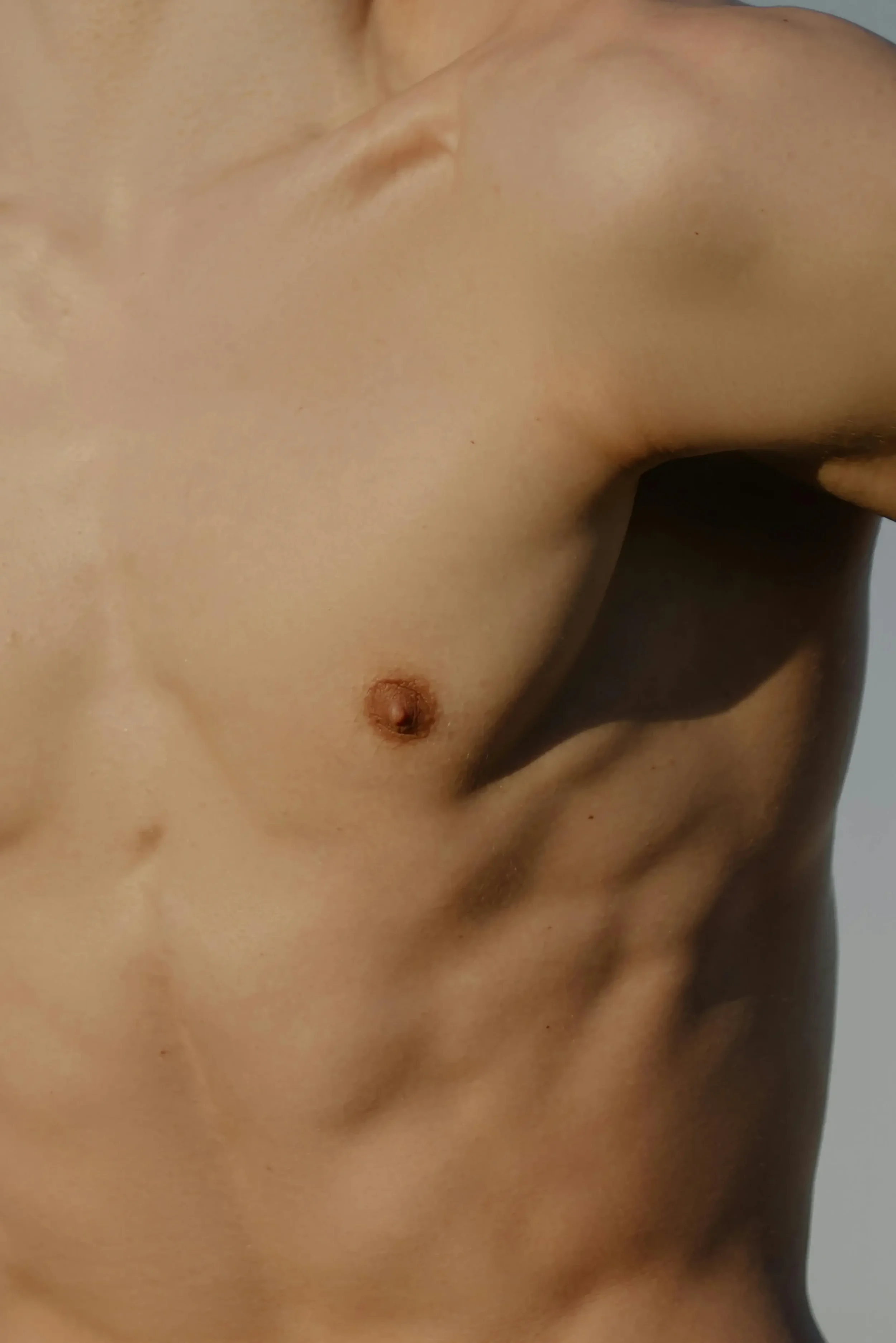 Gynecomastia Surgery in Lebanon: Male Breast Reduction for a Defined, Masculine Chest