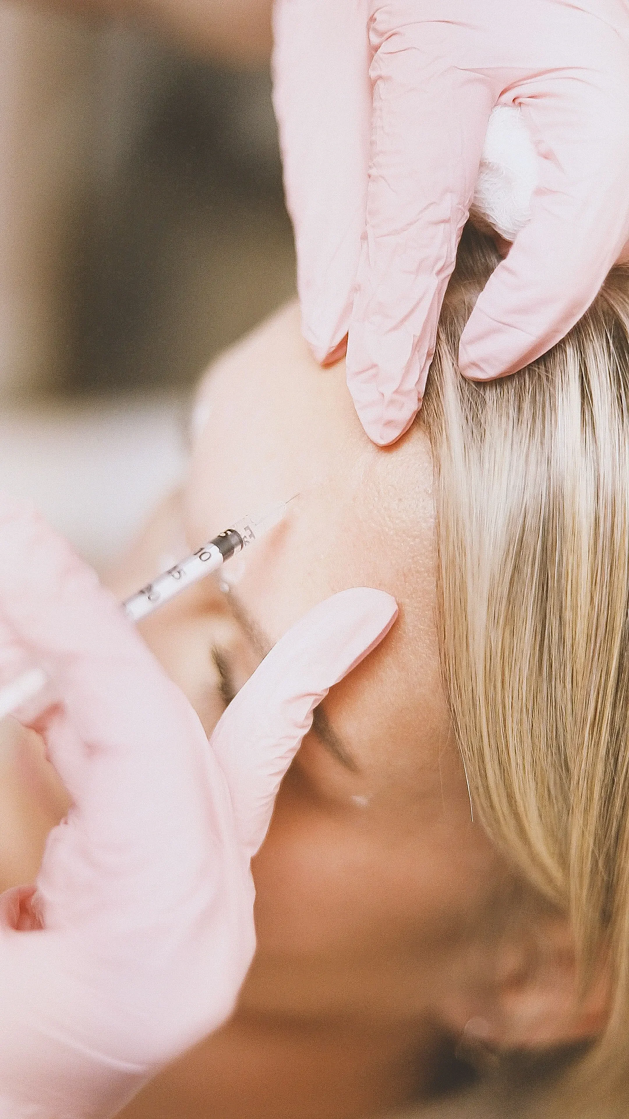 How Many Filler Syringes Do I Need? A Complete Guide to Dermal Fillers and Facial Rejuvenation