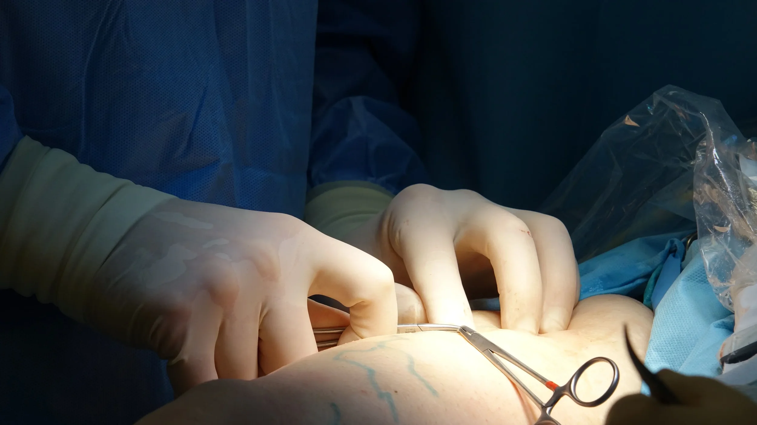 Warning Signs After Plastic Surgery You Should Never Ignore: When to Contact Your Plastic Surgeon