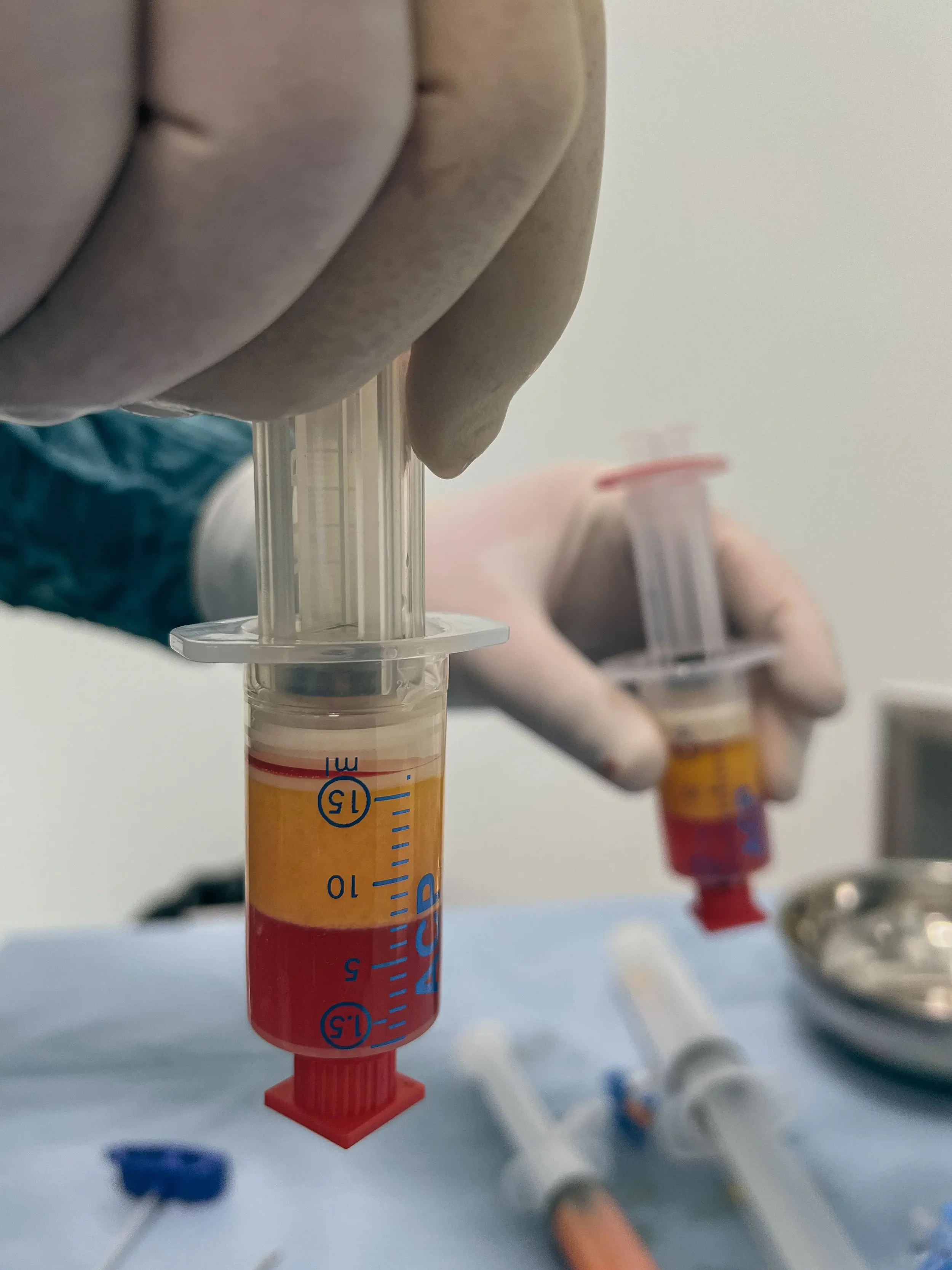 Fat Transfer &amp; Fat Grafting in Plastic Surgery: Indications, Benefits &amp; What to Expect