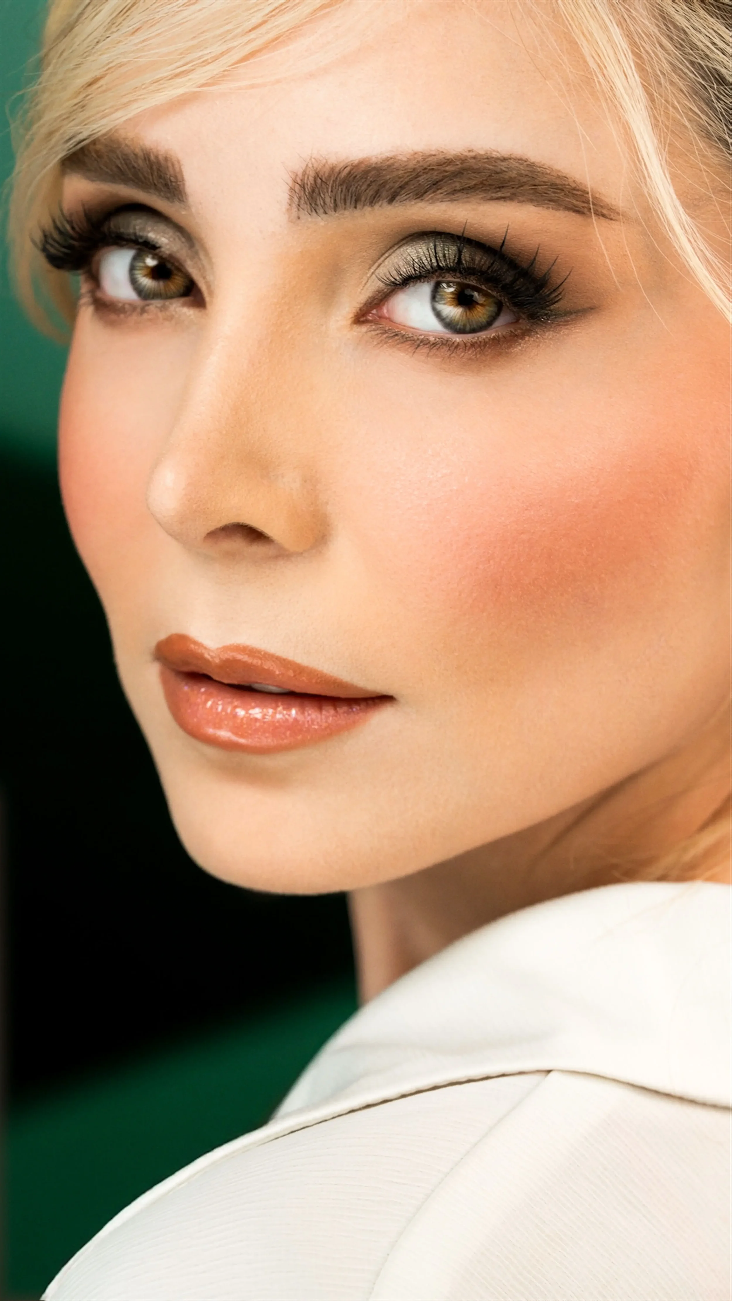 Buccal Fat Pad Removal in Lebanon: Cheek Reduction &amp; Facial Contouring