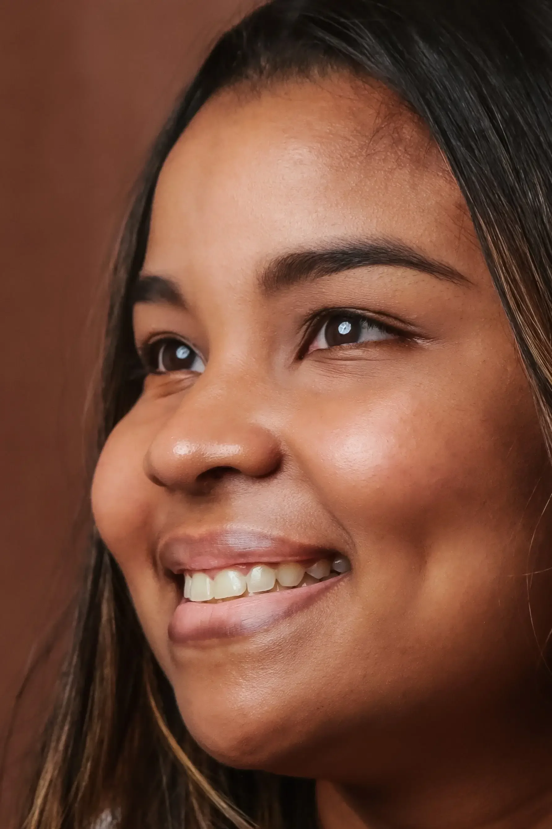 Dimpleplasty in Lebanon: Cheek Dimple Creation Surgery