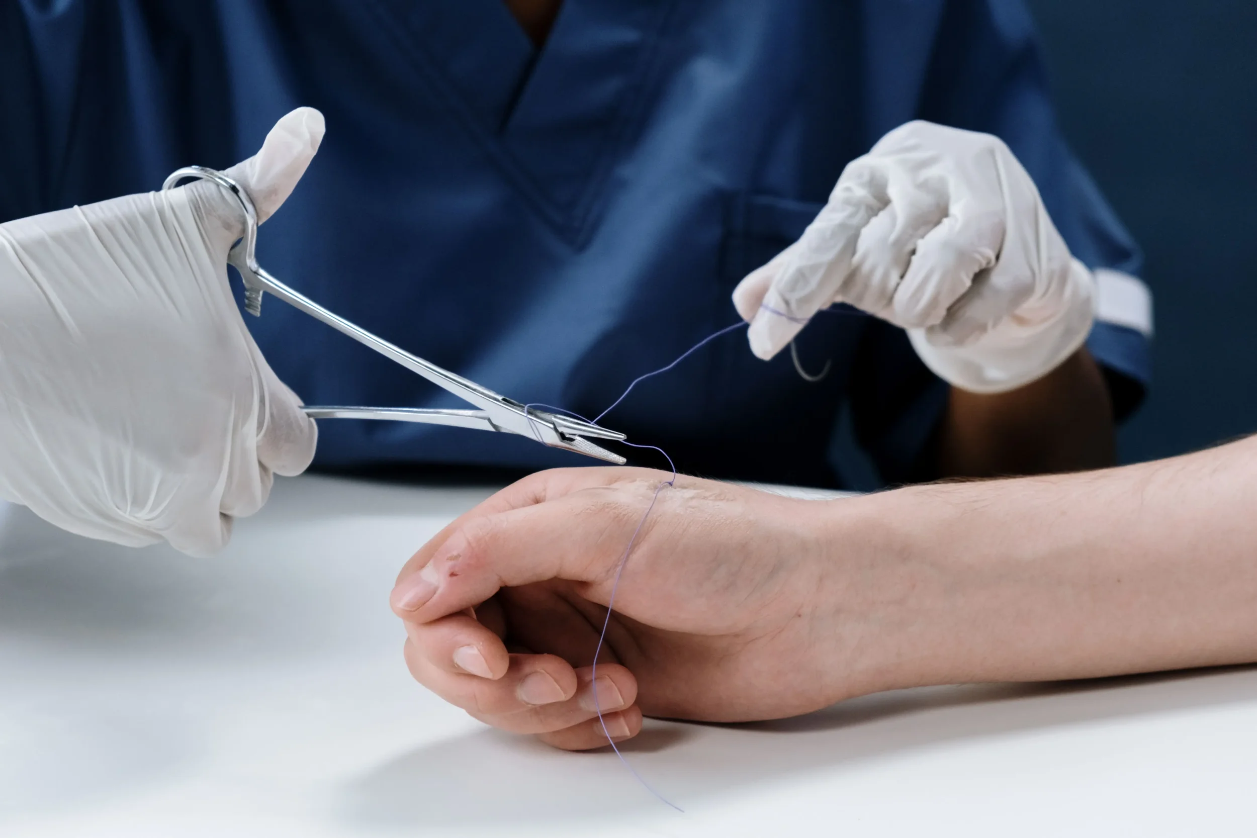 Emergency Wound Stitches in Lebanon: When to Seek Urgent Medical Care