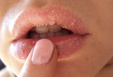 3 Lip Scrub Recipes- Manage Your Kissable Lips