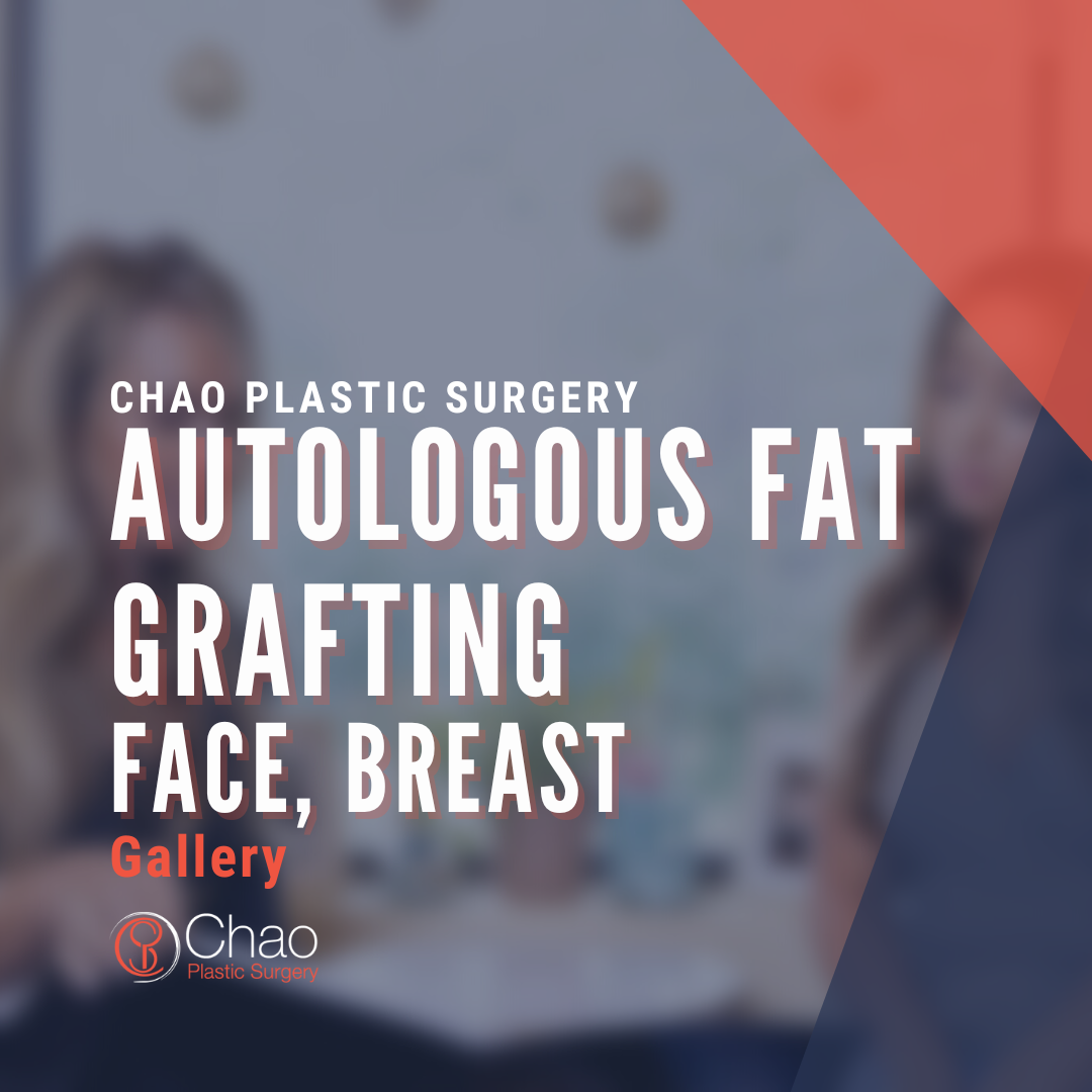Autologous Fat Grafting.png