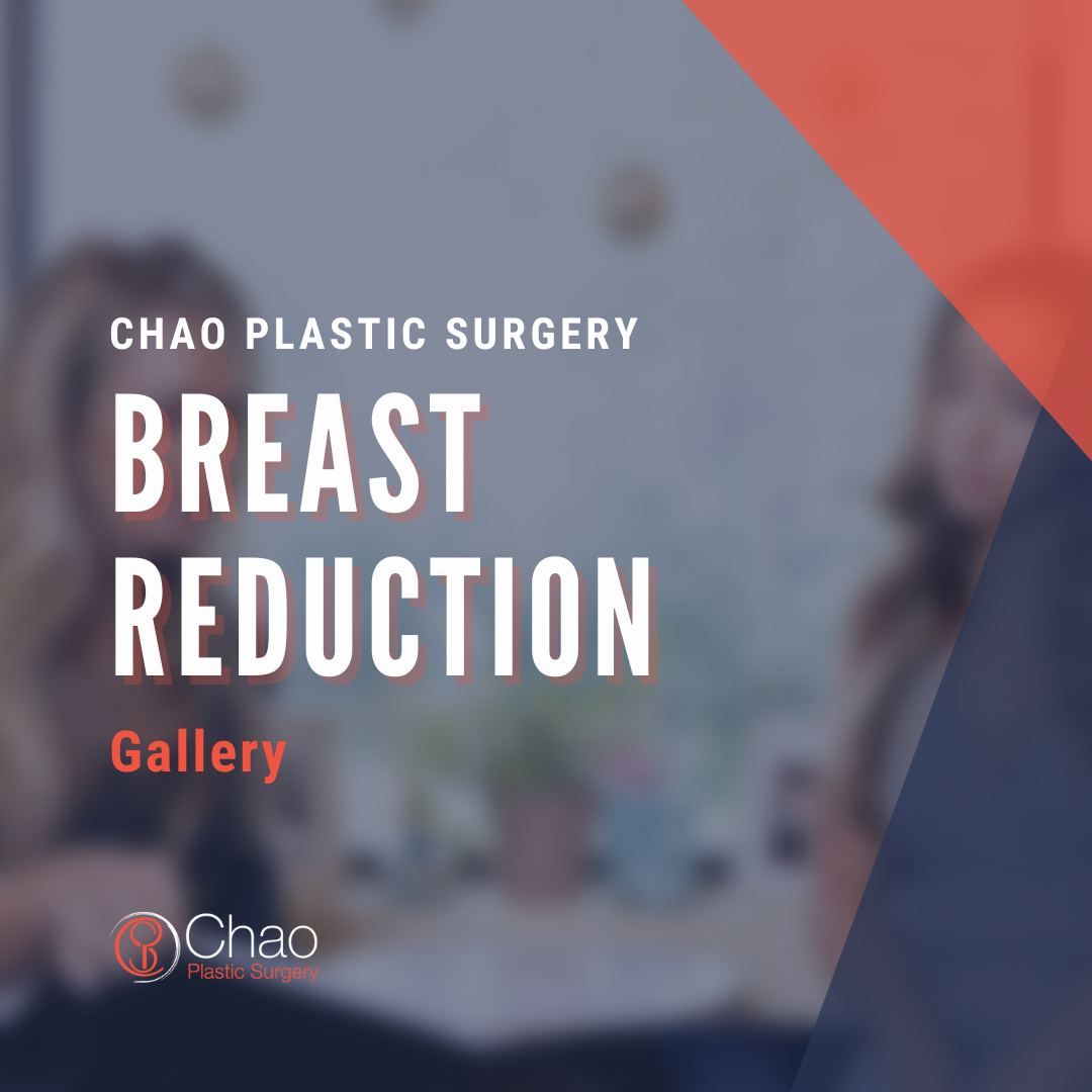 Breast Reduction gallery.png