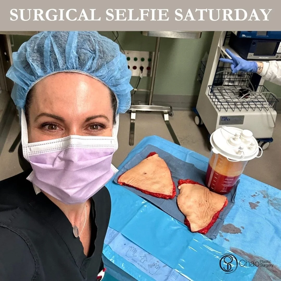 💉 Good morning! It's SURGICAL SELFIE SATURDAY 💉
Here we have our PA Beckie with one of her surgical selfies after she and Dr Chao completed another life changing surgical transformation in the OR.

😷 Treatment: Tummy Tuck (Abdominoplasty) with Fla