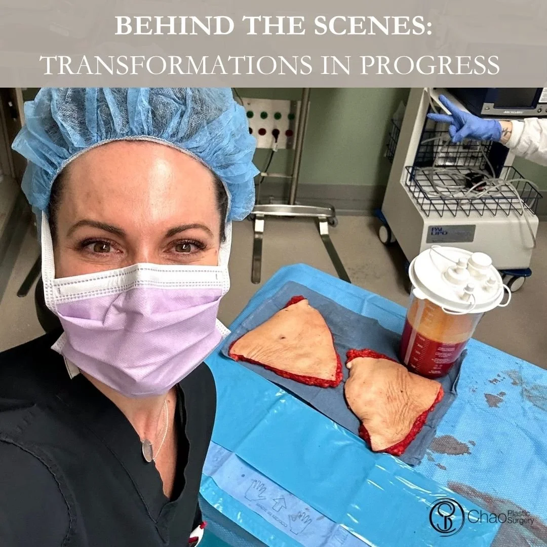 💉 Good morning! It's SURGICAL SELFIE SATURDAY 💉

Here we have our PA Beckie with one of her surgical selfies after she and Dr Chao completed another life changing surgical transformation in the OR.

😷 Treatment: Tummy Tuck (Abdominoplasty) with Fl