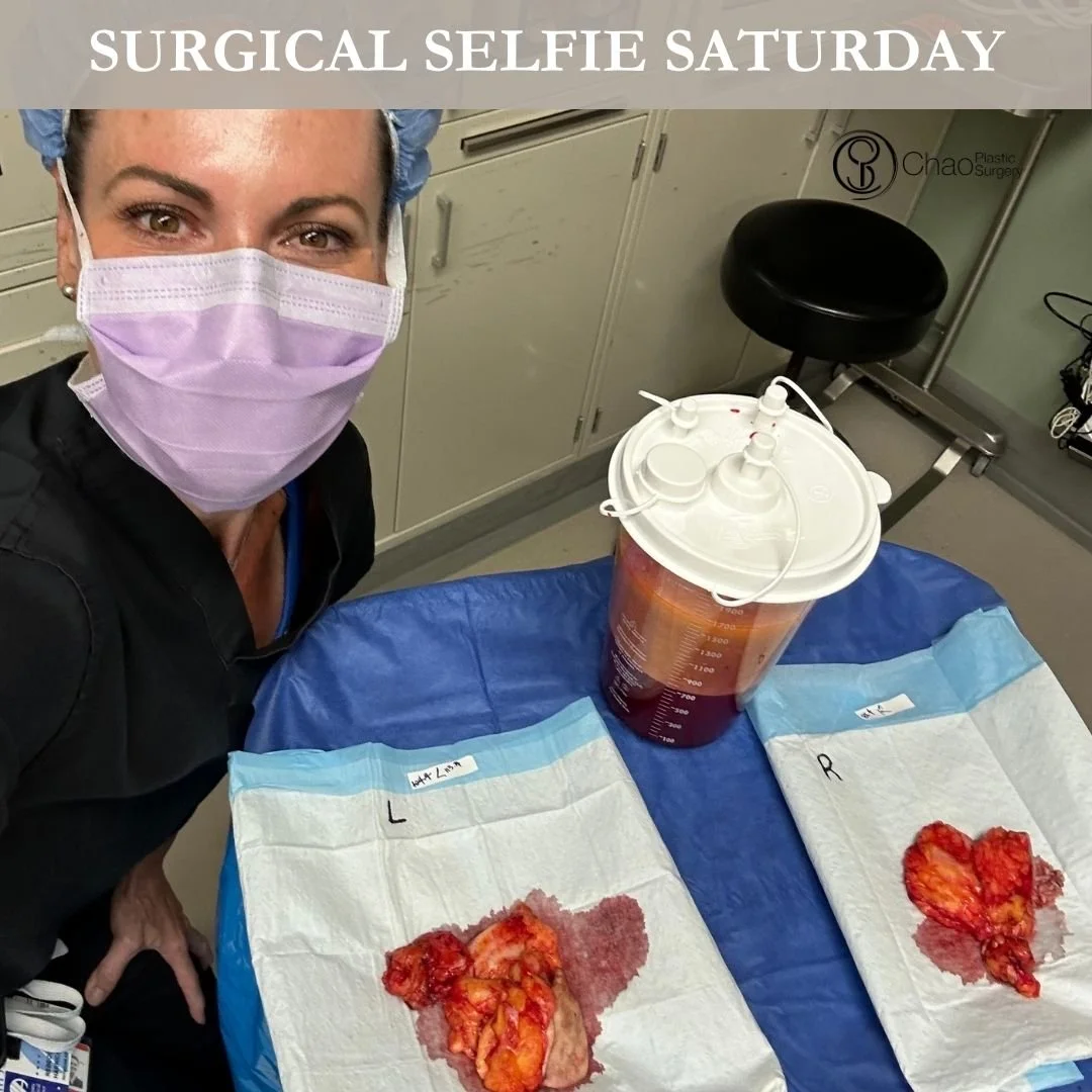 💉 Good morning! It's SURGICAL SELFIE SATURDAY 💉

Here we have our PA Beckie with one of her surgical selfies after she and Dr Chao completed another life changing surgical transformation in the OR.

😷 Treatment: Breast Lift/Reduction with Abdomina