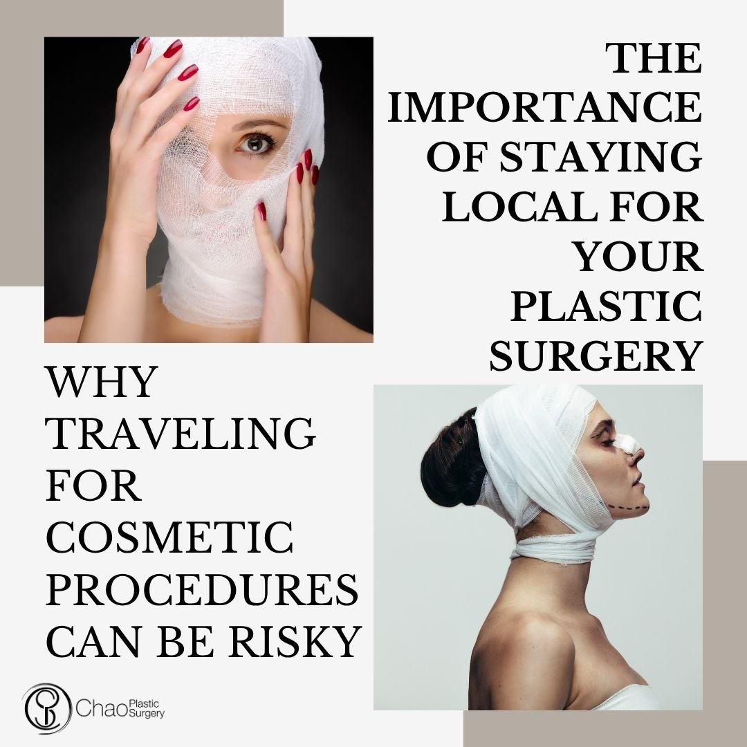 With the rise of medical tourism and bargain surgery offers, it's tempting to travel out of state or even out of the country for cosmetic procedures. However, choosing a local, board-certified surgeon like Dr. Chao at Chao Plastic Surgery offers cruc