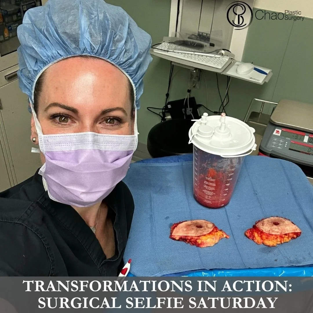 💉 Good morning! It's SURGICAL SELFIE SATURDAY 💉

Here we have our PA Beckie with one of her surgical selfies after she and Dr Chao completed another life changing surgical transformation in the OR.

😷 Treatment: Gynecomastia Surgery with Free Nipp