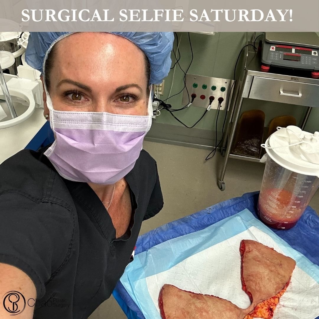 💉 Good morning! It's SURGICAL SELFIE SATURDAY 💉

Here we have our PA Beckie with one of her surgical selfies after she and Dr Chao completed another life changing surgical transformation in the OR.

😷 Treatment: Tummy Tuck (Abdominoplasty) with Fl