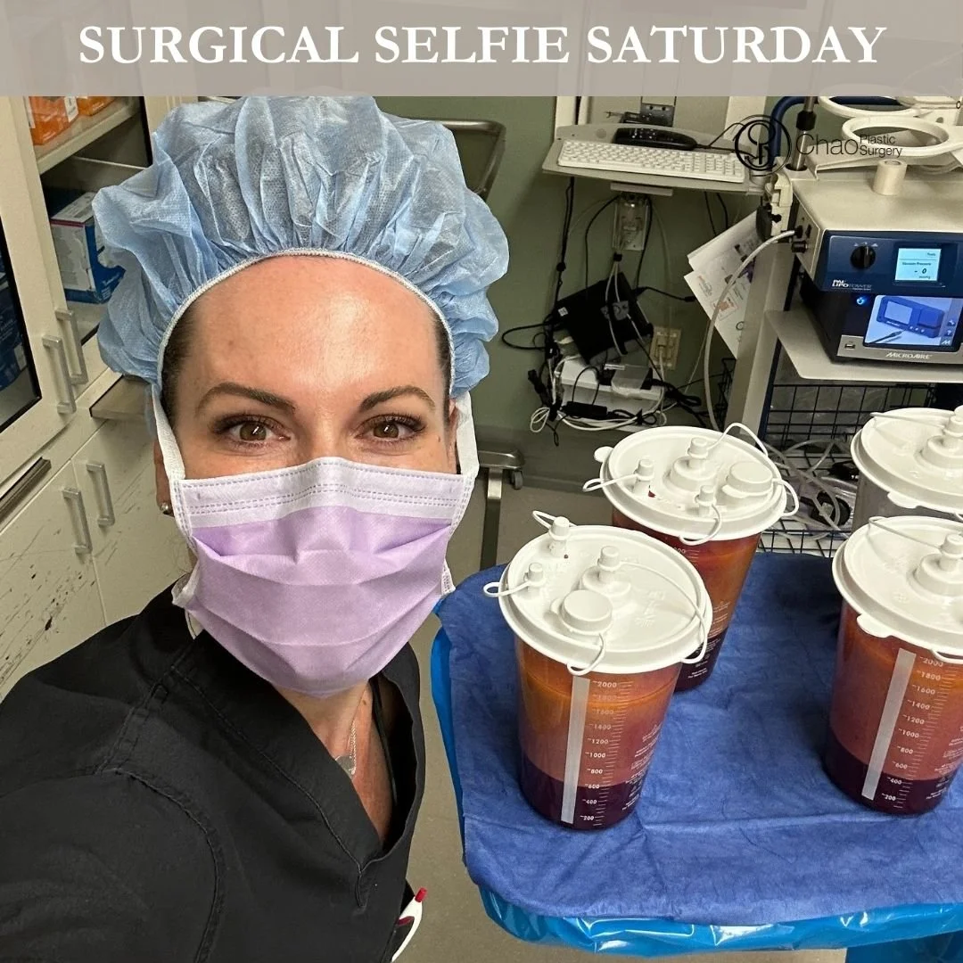 💉 Good morning! It's SURGICAL SELFIE SATURDAY 💉

Here we have our PA Beckie with one of her surgical selfies after she and Dr Chao completed another life changing surgical transformation in the OR.

😷 Treatment: 360 Liposuction 
🎯 Purpose: Compre