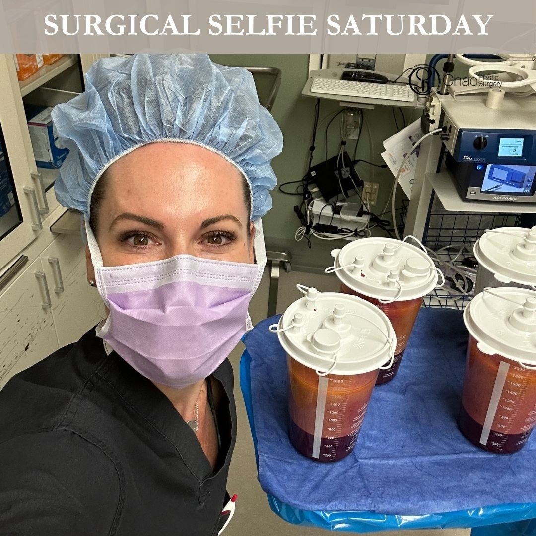 💉 Good morning! It's SURGICAL SELFIE SATURDAY 💉

Here we have our PA Beckie with one of her surgical selfies after she and Dr Chao completed another life changing surgical transformation in the OR.

😷 Treatment: 360 Liposuction 
🎯 Purpose: Compre