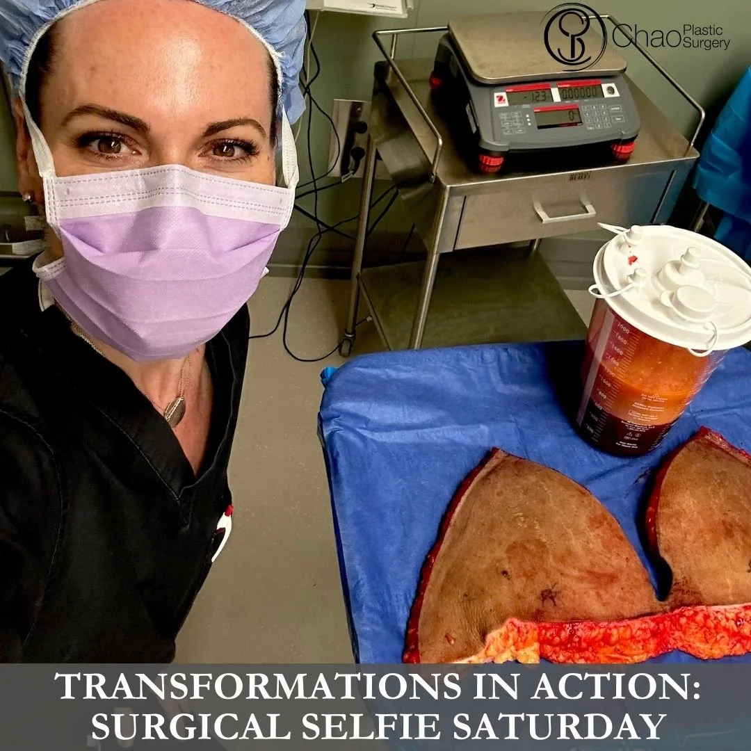 💉 Good morning! It's SURGICAL SELFIE SATURDAY 💉

Here we have our PA Beckie with one of her surgical selfies after she and Dr Chao completed another life changing surgical transformation in the OR.

😷 Treatment: Abdominoplasty with Flank Liposucti