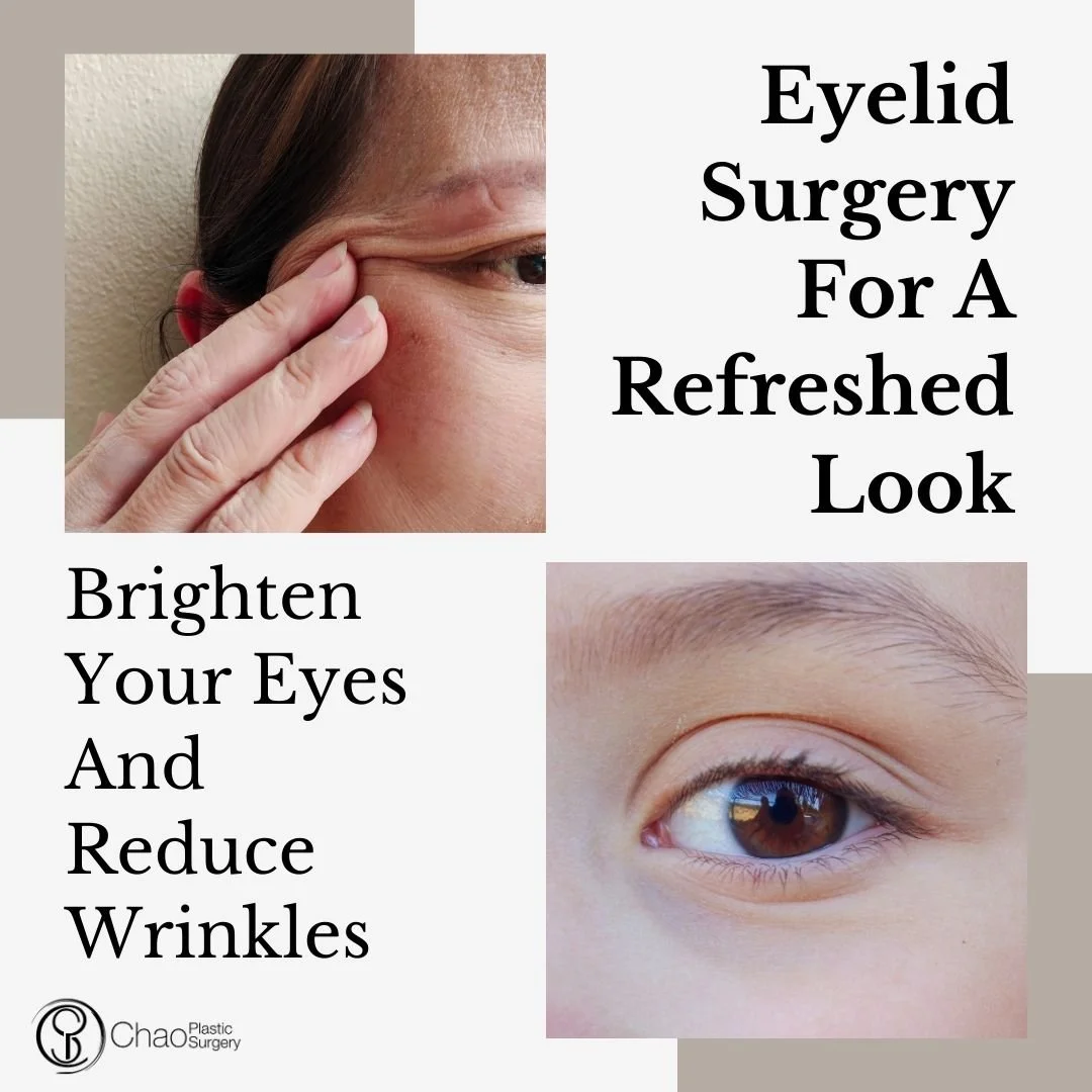 Sagging or hooded upper eyelids and under-eye bags can make you look tired or aged. Upper and lower lid blepharoplasty at Chao Plastic Surgery helps restore a youthful, refreshed appearance by lifting drooping lids and smoothing under-eye fullness&md