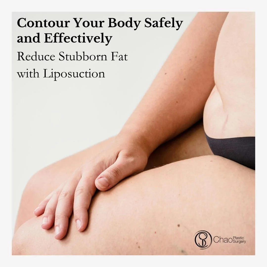 Stubborn fat in areas like the abdomen, thighs, or chin can be frustrating. Our liposuction procedures provide safe, precise fat removal for a sculpted, natural look. Patients leave feeling more confident and proud of their body contours.

🌟 Sculpt 