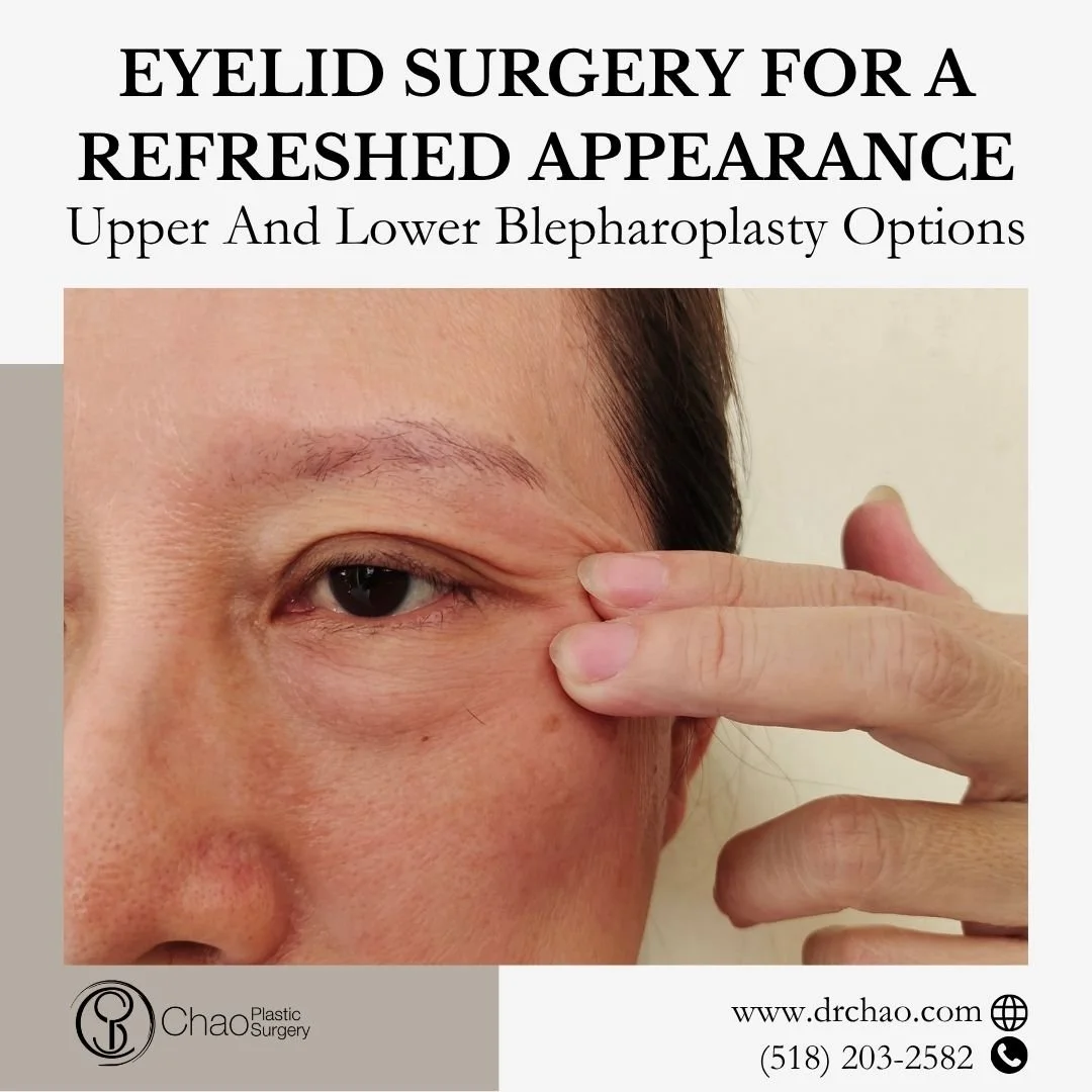 Tired or aged-looking eyes can affect your entire facial expression. Upper and lower blepharoplasty helps restore a more rested, youthful appearance while maintaining your natural eye shape. 🌟

This procedure is carefully tailored to reduce sagging 