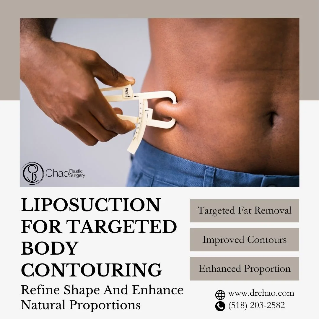 Even with consistent diet and exercise, certain areas of fat can be resistant to change. Liposuction is designed to target these stubborn pockets and refine body contours for a smoother, more balanced shape. 🌟

Our approach focuses on natural-lookin
