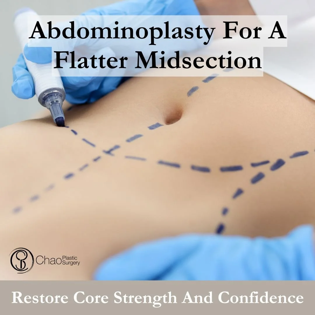 A tummy tuck, or abdominoplasty, is designed to remove excess skin and tighten abdominal muscles for a smoother, more defined midsection. 🌟

This procedure is often chosen after pregnancy or significant weight changes, helping restore both body cont