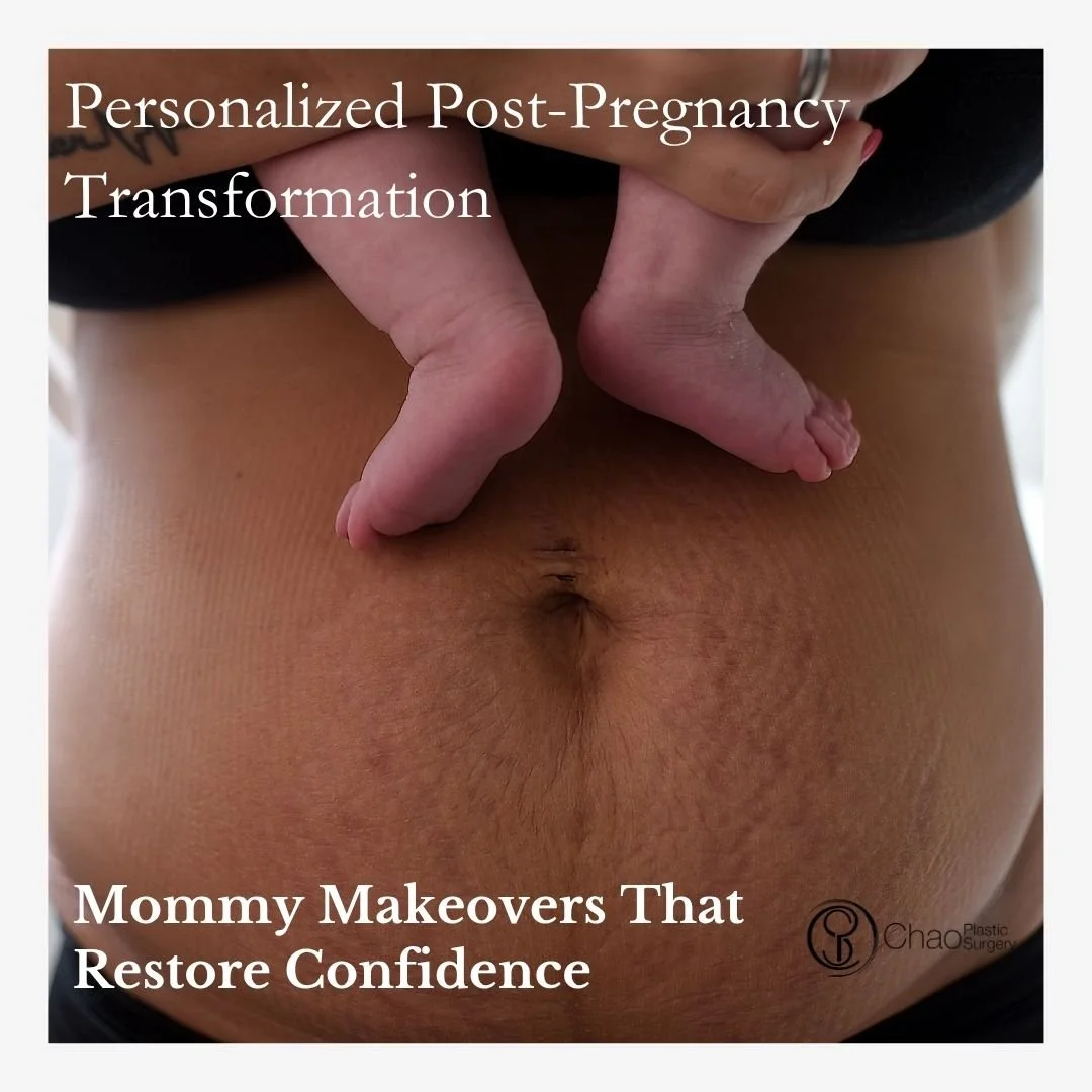 Pregnancy and childbirth can bring lasting changes to the body, and a Mommy Makeover is designed to address those changes in a fully customized way. 🌟

Combining procedures such as breast surgery, tummy tuck, and liposuction, each treatment plan is 
