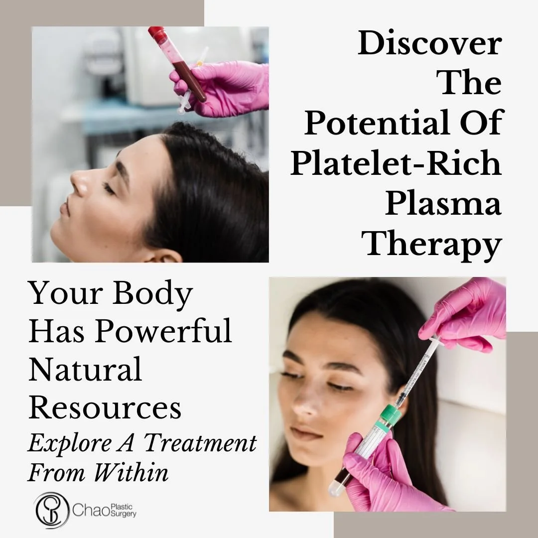 Platelet-rich plasma, or PRP , and platelet-rich fibrin matrix or PRFM use components from your own blood to support the body's natural repair processes. At Chao Plastic Surgery and Vigour Aesthetics + Wellness, A Chao Plastic Surgery Med Spa, PRP &a