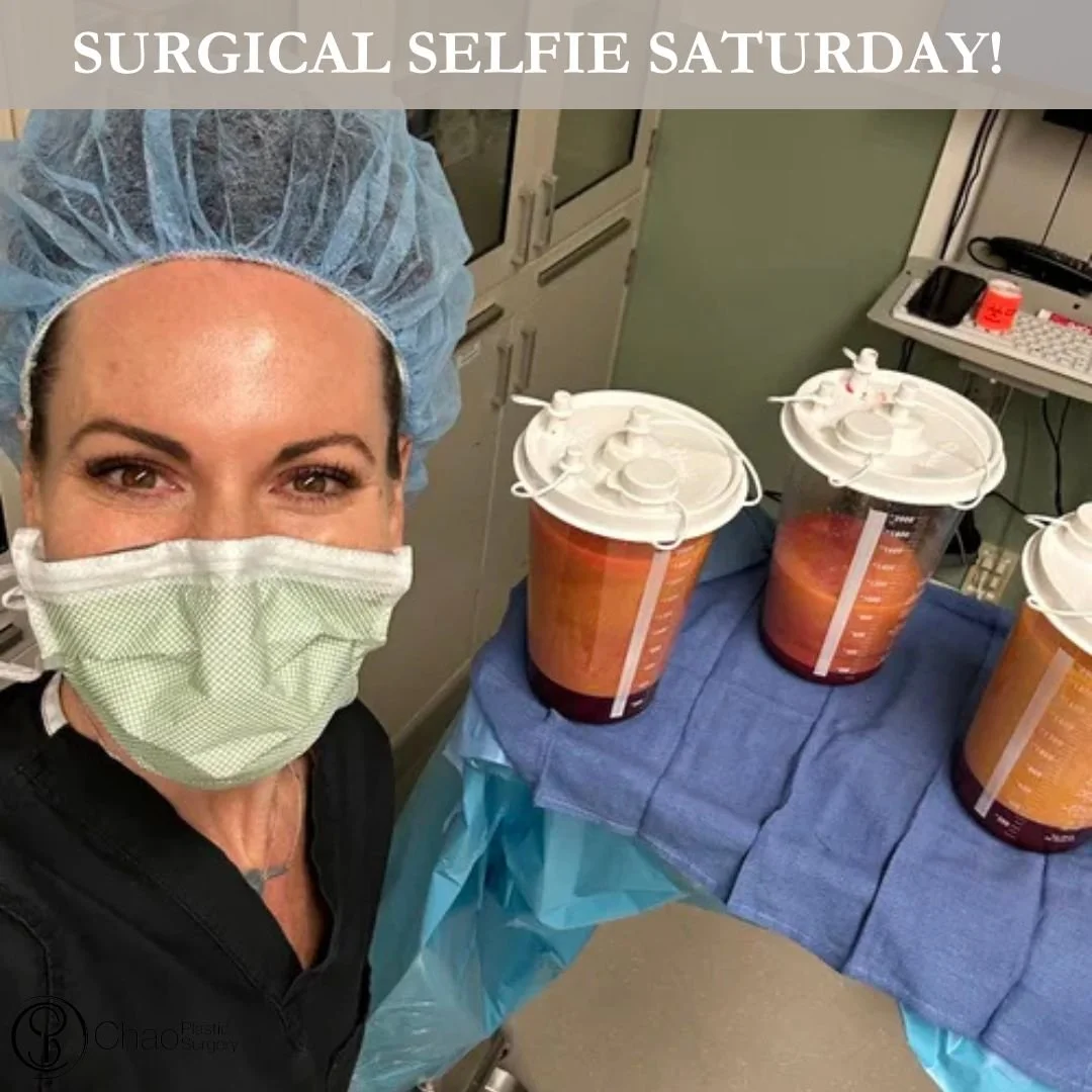 Your body doesn't have just one angle, so body contouring shouldn't focus on just one area. Lipo 360 is designed to address stubborn fat around multiple areas of the body to create a more balanced overall silhouette. 

Each procedure is carefully pla