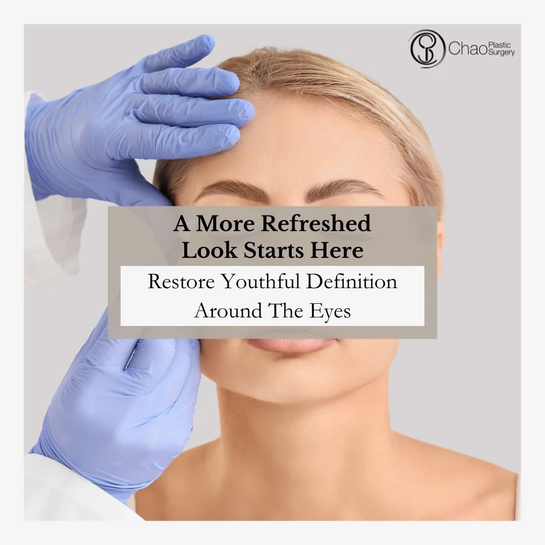 Do your eyes make you look more tired than you feel? Blepharoplasty, or eyelid lift surgery, can address excess skin and tissue on the upper and lower eyelids to create a more refreshed, youthful appearance.

Dr. Chao takes a personalized approach to