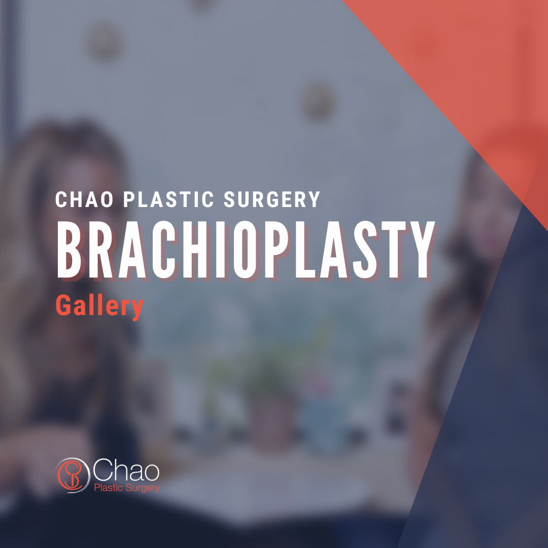 Brachioplasty.png