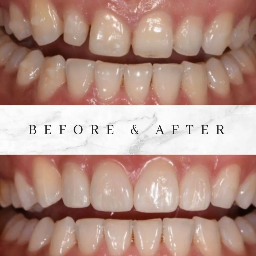 Teeth 2.jpeg