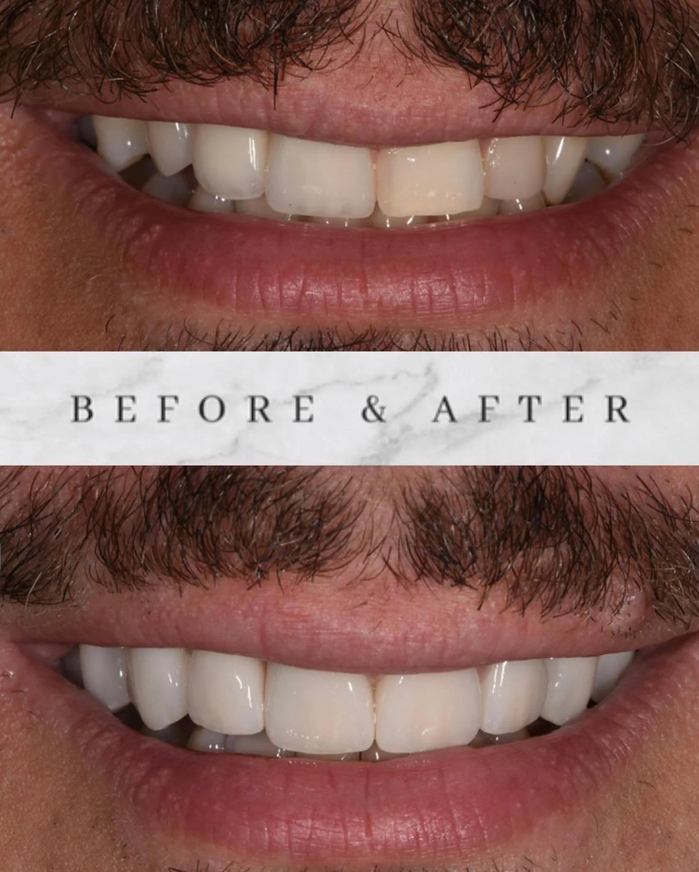 Best Dentist Vancouver