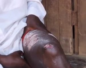 Uganda: Islamic School Headmaster Fired and Burned for Becoming Christian