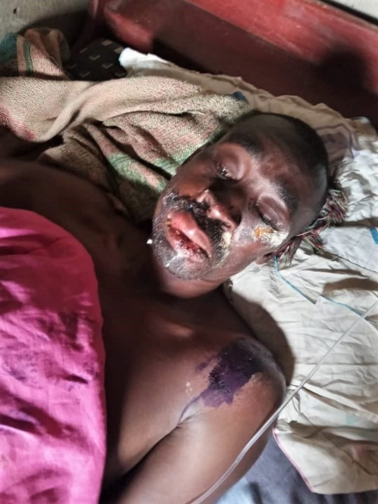 Uganda: Pastor Sprayed with Acid in Ambush in Kampala