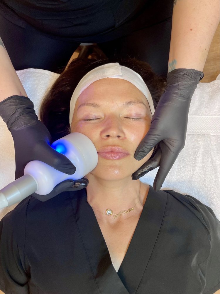 Neveskin cryofacial applicator used on a client’s cheek at Recoupia in Lynnwood