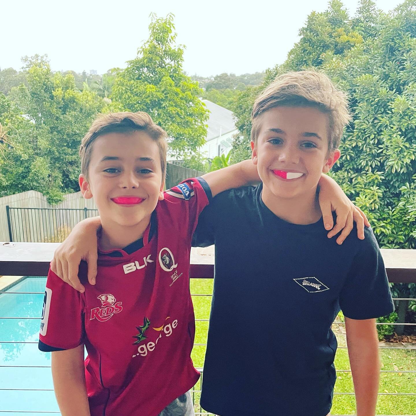One of the most important items to go in the sports bag is a custom made mouthguard from @restorehygiene to protect those smiles 😁
Hope the weather clears up for all the sport this weekend!
.
.
.
.
#childrensdentistry #chermsidedentist #brisbanedent