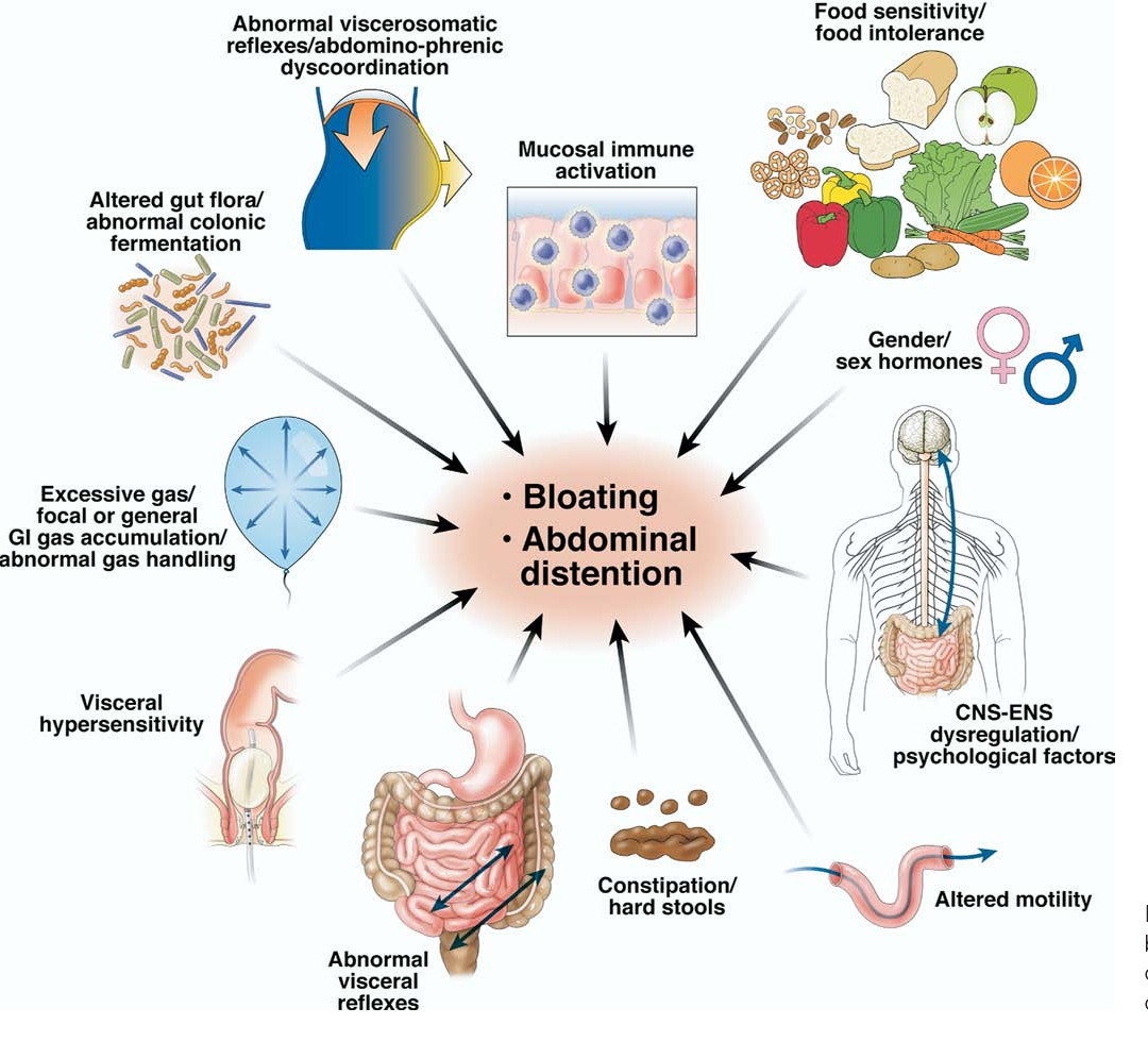 Calgary Bloating Relief Find Natural Solutions With Homeopathy At 