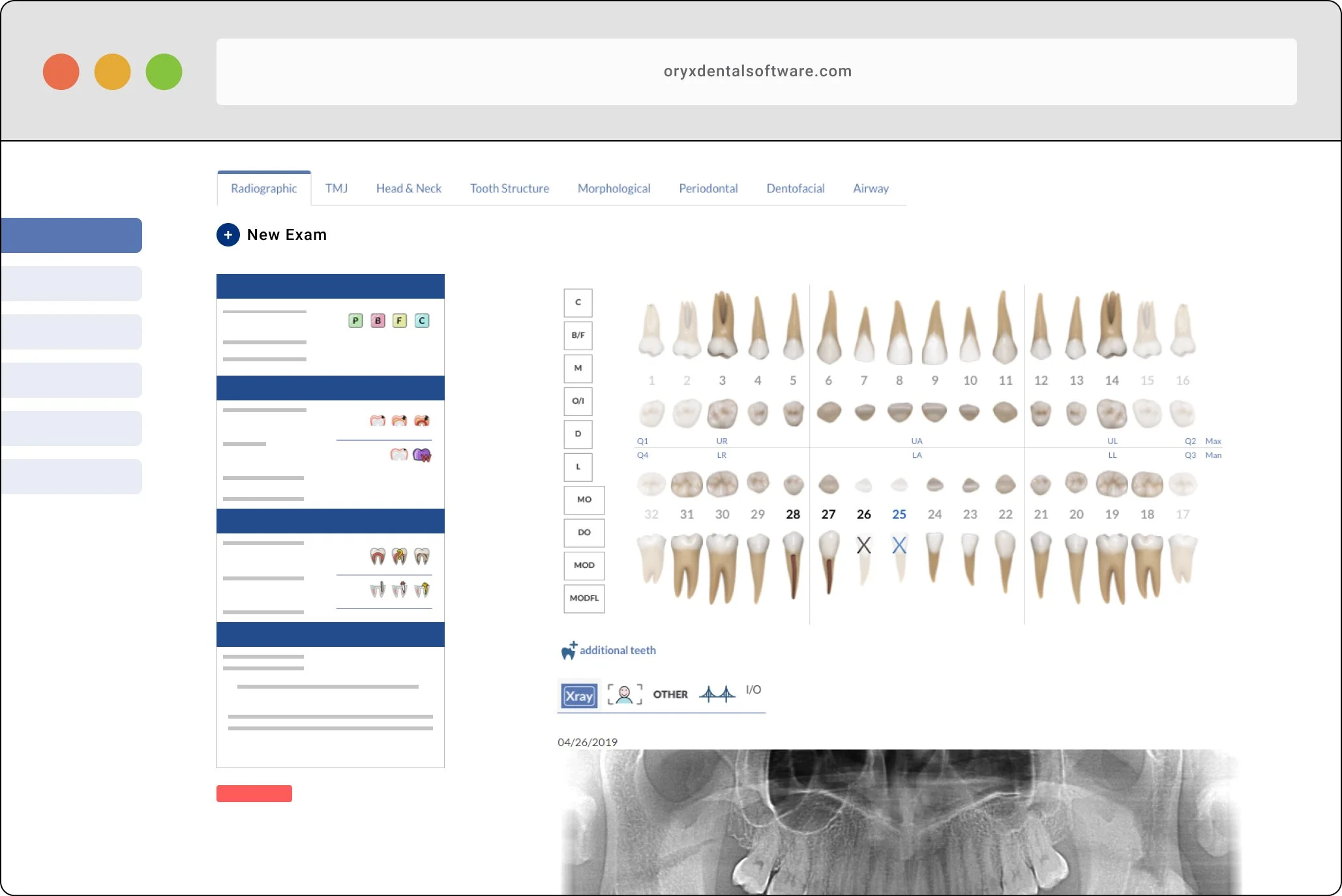 Oryx Dental Software