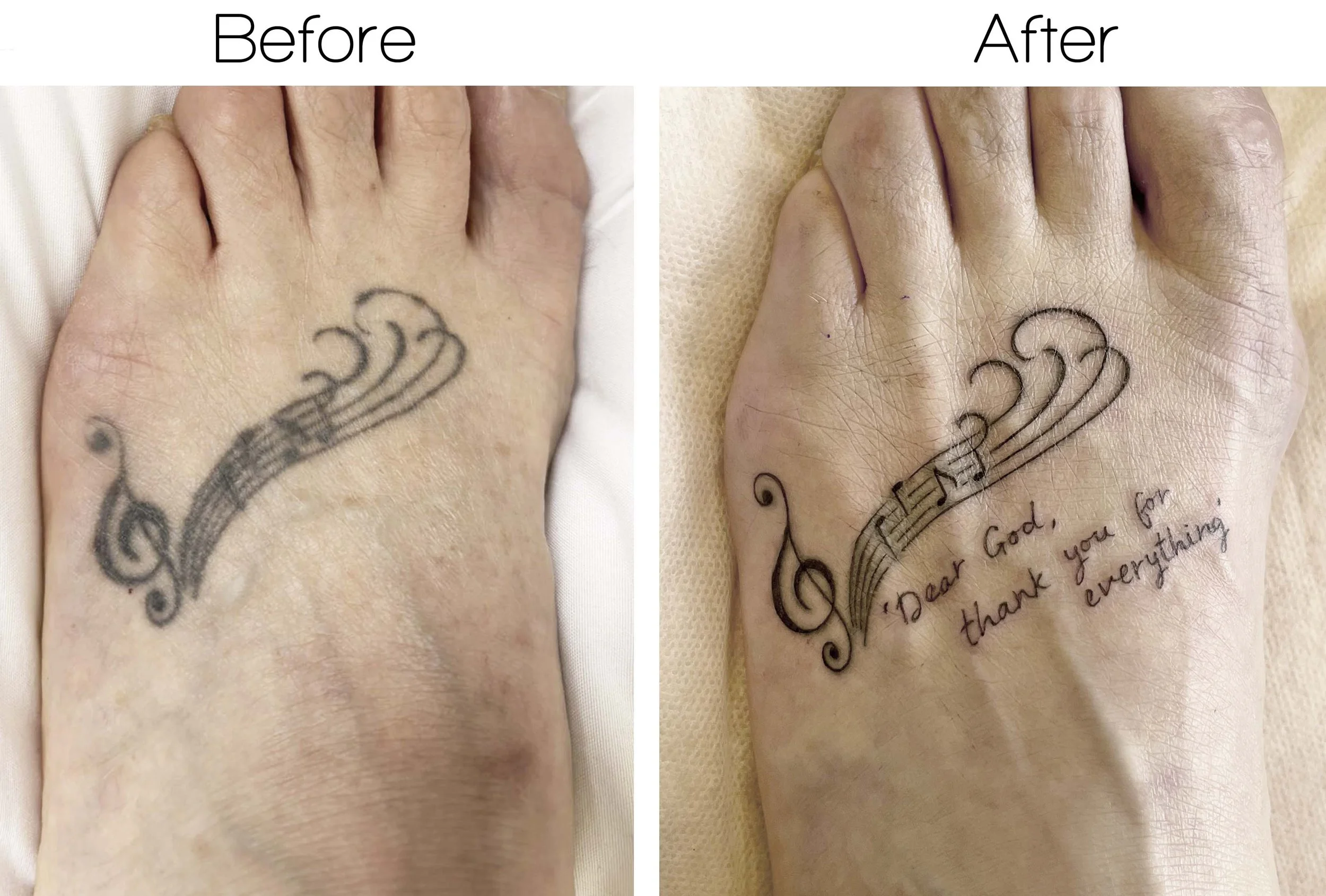 before after template copy.jpg