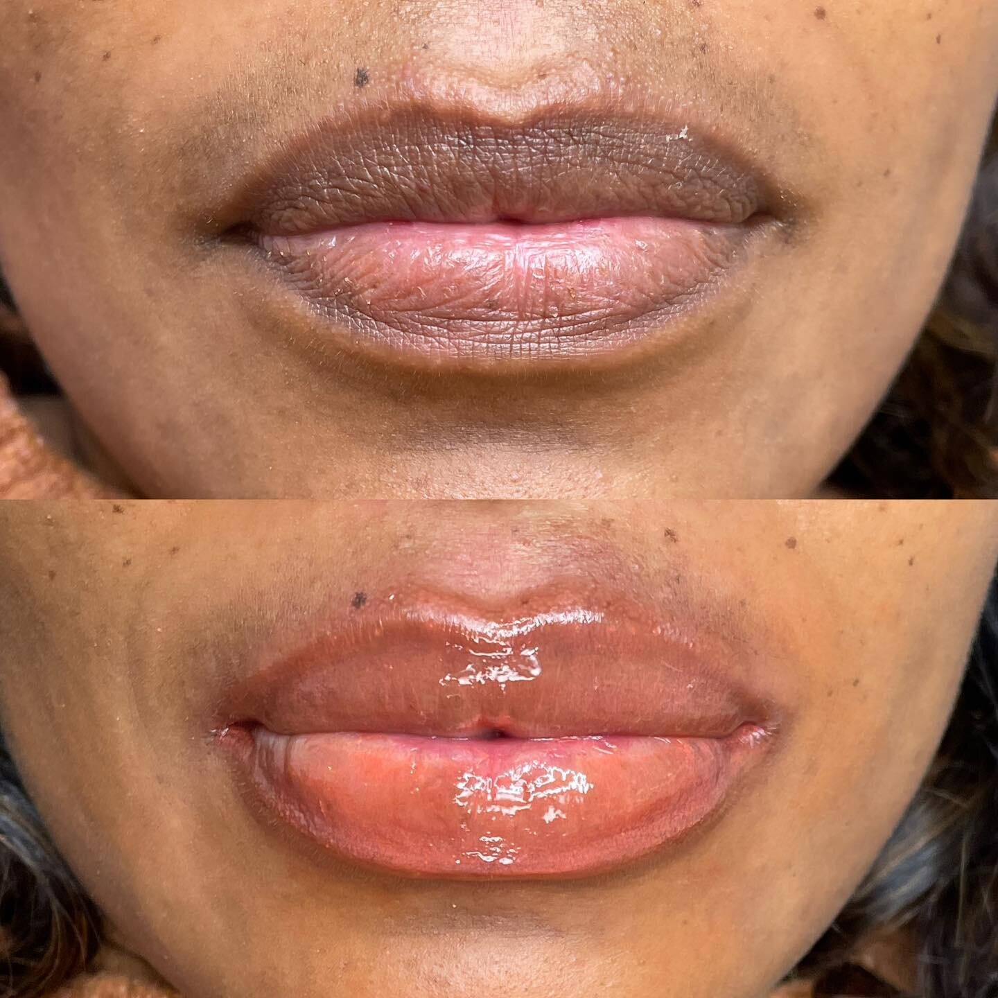 Dark lip neutralization -first session #lipblush #darklipscorrection #darklipneutralization #darklipcorrection #lipblushnyc #liptattoo #lipblushing