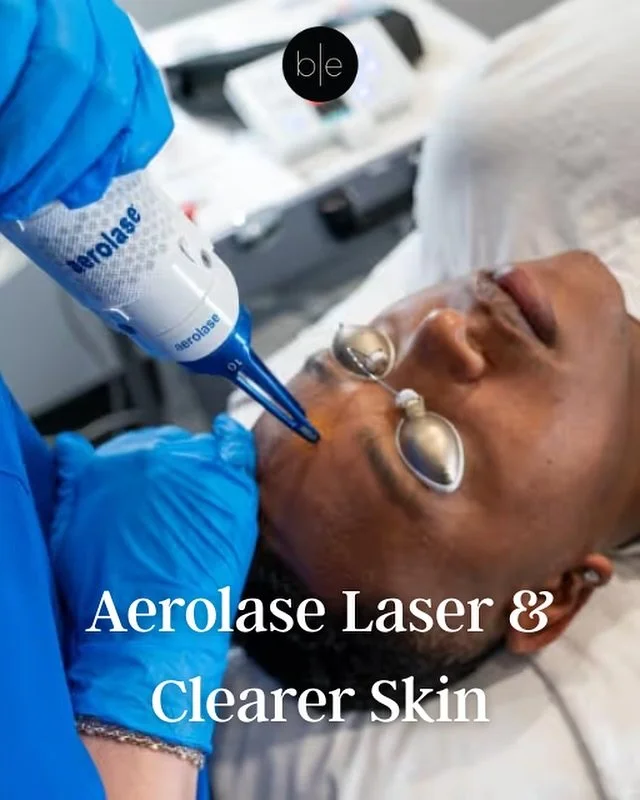 Aerolase Acne Treatment &mdash; Clearer Skin Starts Now

Here&rsquo;s why it&rsquo;s a game-changer:
	&bull;Deep energy penetrates to reduce excess oil production (sebum) and quiet inflammation ￼
	&bull;Destroys P. acnes bacteria and helps prevent fu