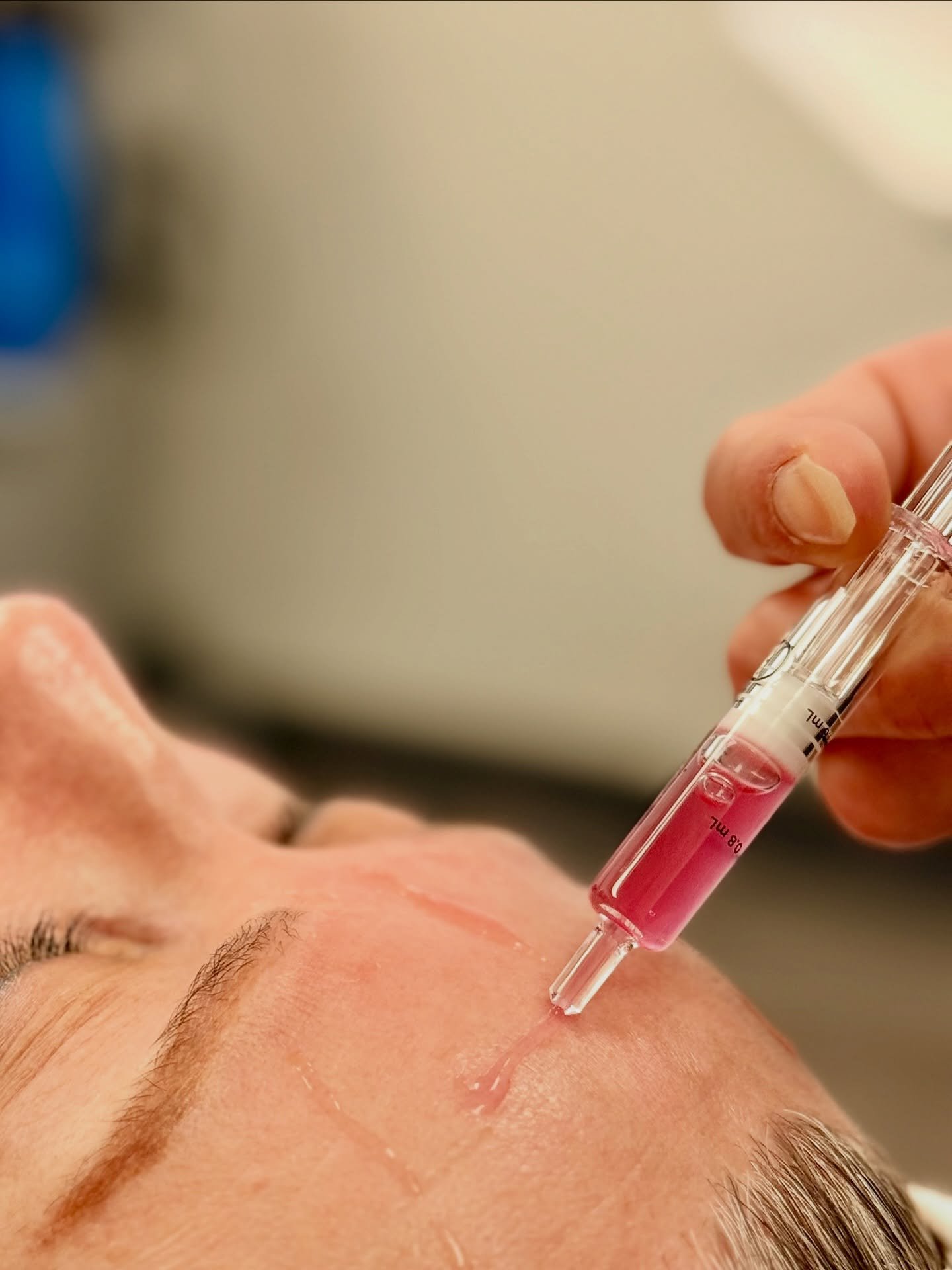 Post-laser glow, amplified.

At Beyond Esthetics MN, we take your results a step further by adding exosomes after treatments like laser facials, SkinPen, or Osmosis facials.

These powerful, regenerative serums help:
	&bull;Speed up healing
	&bull;Ca